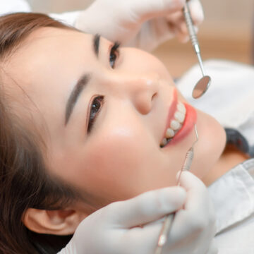 Dental Crowns