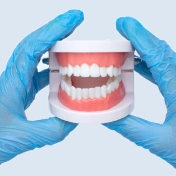 Partial and Full Dentures